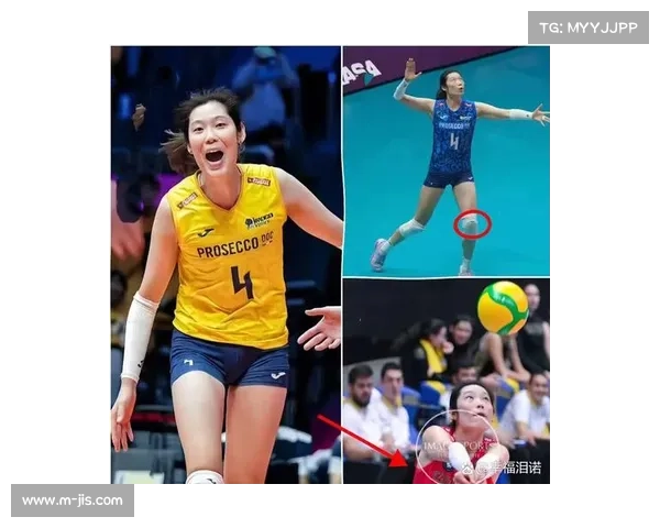 朱婷手腕手术后状态成疑，欧冠表现关系世俱杯备战